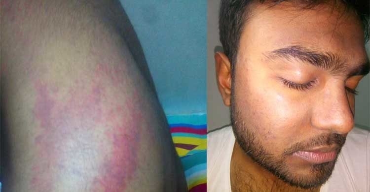 আবরারের মতো আইআইইউসি ছাত্রকে পেটালো ছাত্রলীগ!
