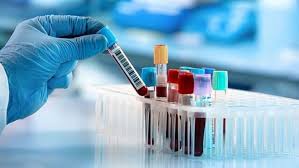 বহির্বিশ্বে প্রশ্নের মুখে বাংলাদেশের ক‌রোনা পরীক্ষা!